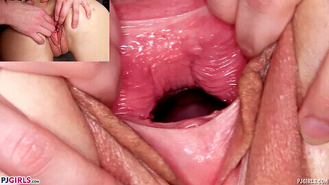 Nastolatki u ginekologa, close up cervix, cipka nastolatki z bliska